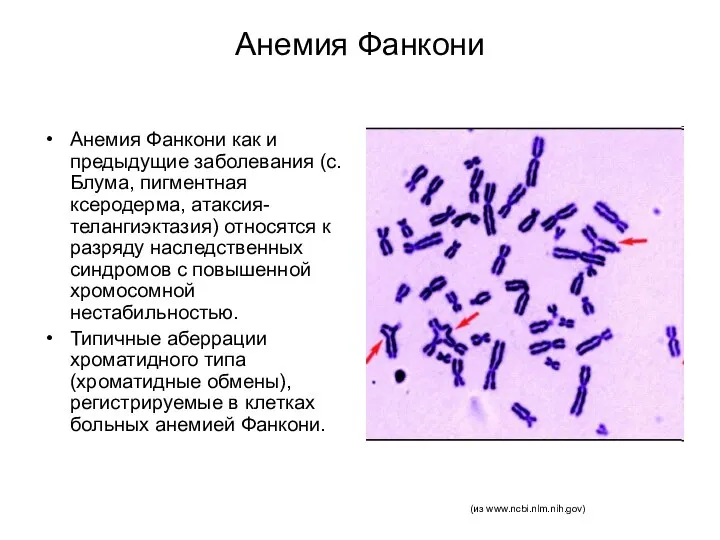 Анемия Фанкони Анемия Фанкони как и предыдущие заболевания (с. Блума, пигментная