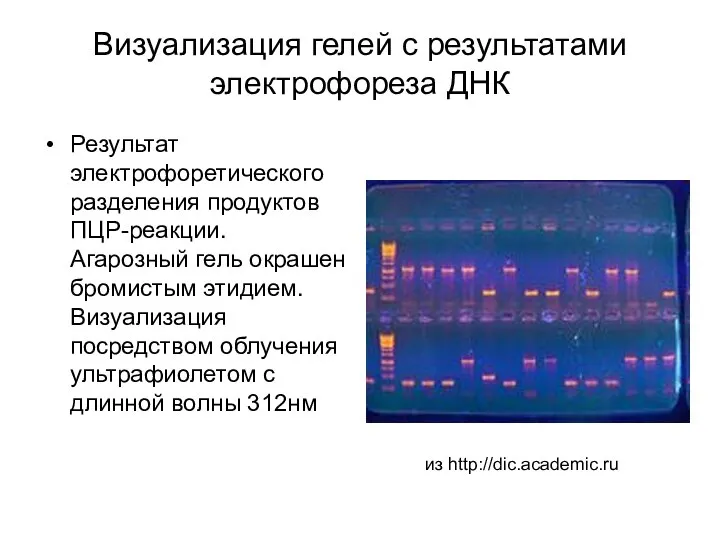 Визуализация гелей с результатами электрофореза ДНК Результат электрофоретического разделения продуктов ПЦР-реакции.