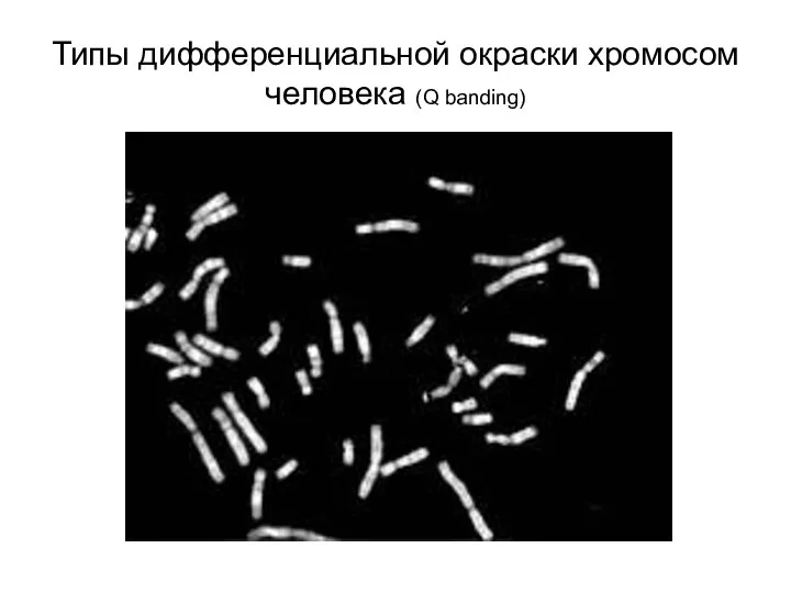 Типы дифференциальной окраски хромосом человека (Q banding)