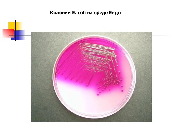 Колонии E. coli на среде Ендо