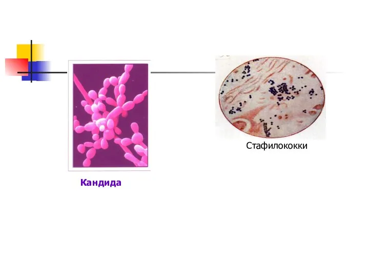 Стафилококки Кандида