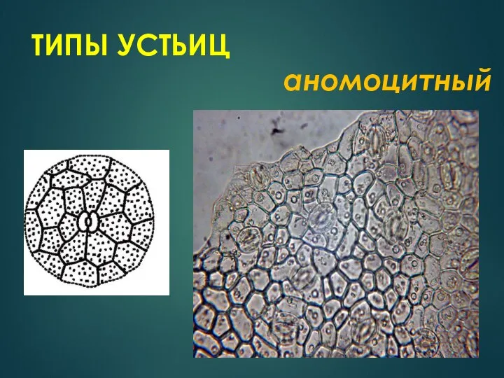 ТИПЫ УСТЬИЦ аномоцитный