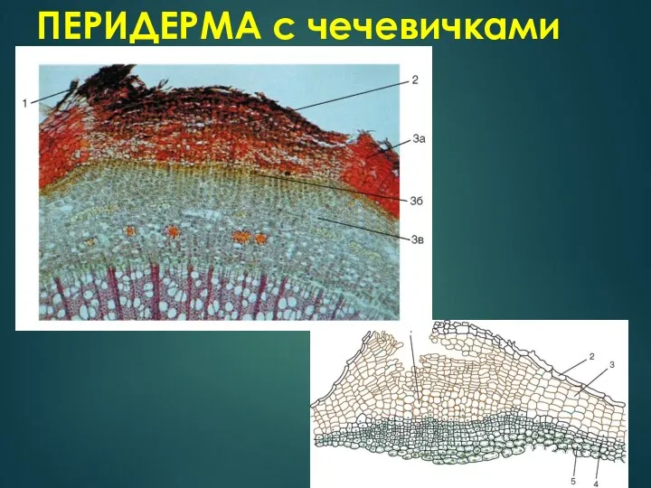 ПЕРИДЕРМА с чечевичками