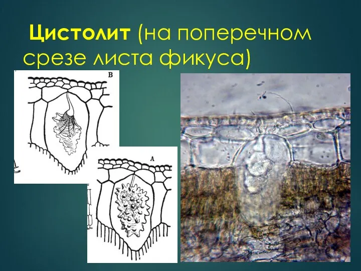 Цистолит (на поперечном срезе листа фикуса)