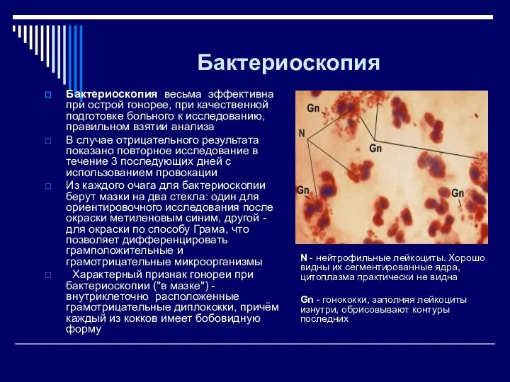 Бактериоскопия Бактериоскопия весьма эффективна при острой гонорее, при качественной подготовке больного