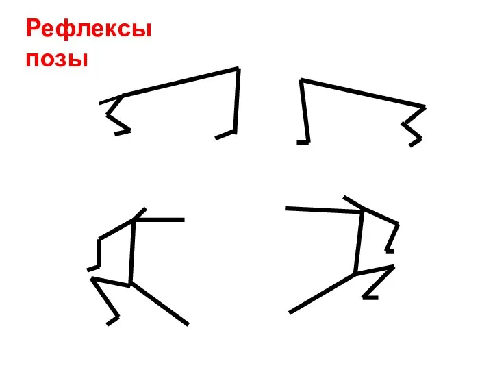 Рефлексы позы