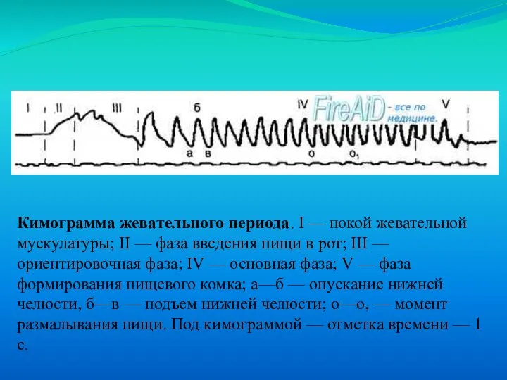 Кимограмма жевательного периода. I — покой жевательной мускулатуры; II — фаза