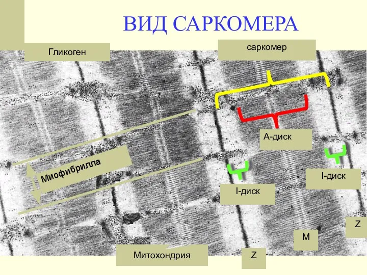 ВИД САРКОМЕРА