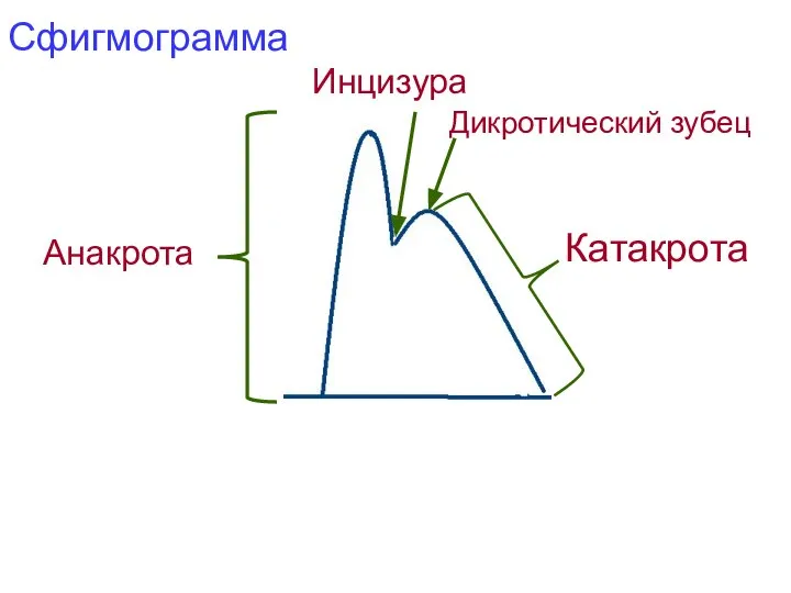 Сфигмограмма Анакрота Инцизура Дикротический зубец Катакрота