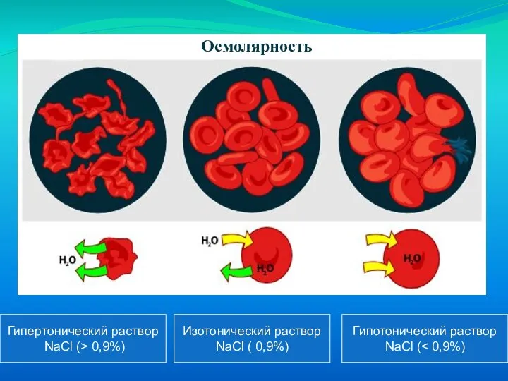 Гипертонический раствор NaCl (> 0,9%) Изотонический раствор NaCl ( 0,9%) Гипотонический раствор NaCl ( Осмолярность