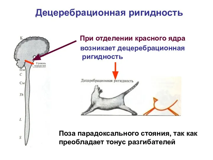 Децеребрационная ригидность При отделении красного ядра возникает децеребрационная ригидность Поза парадоксального