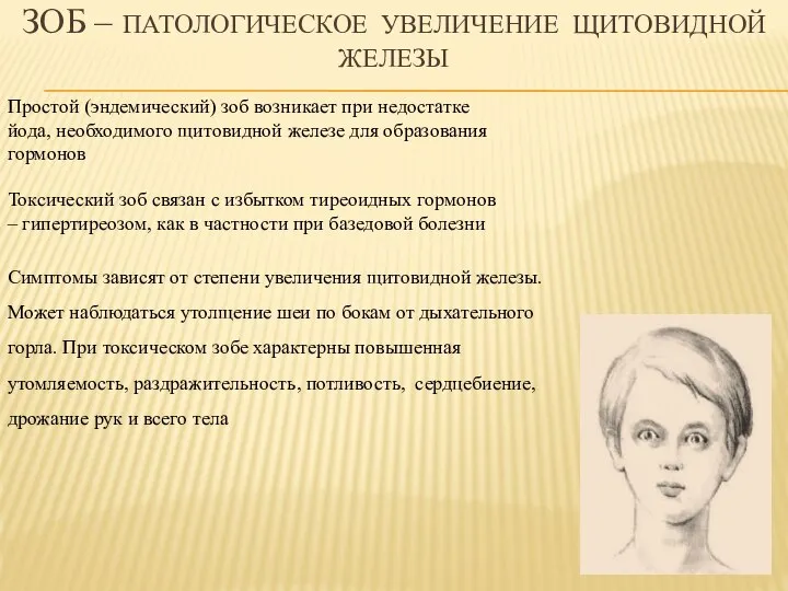 Зоб – патологическое увеличение щитовидной железы Простой (эндемический) зоб возникает при