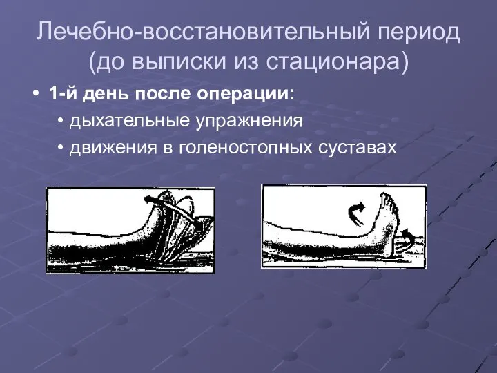 Лечебно-восстановительный период (до выписки из стационара) 1-й день после операции: дыхательные упражнения движения в голеностопных суставах