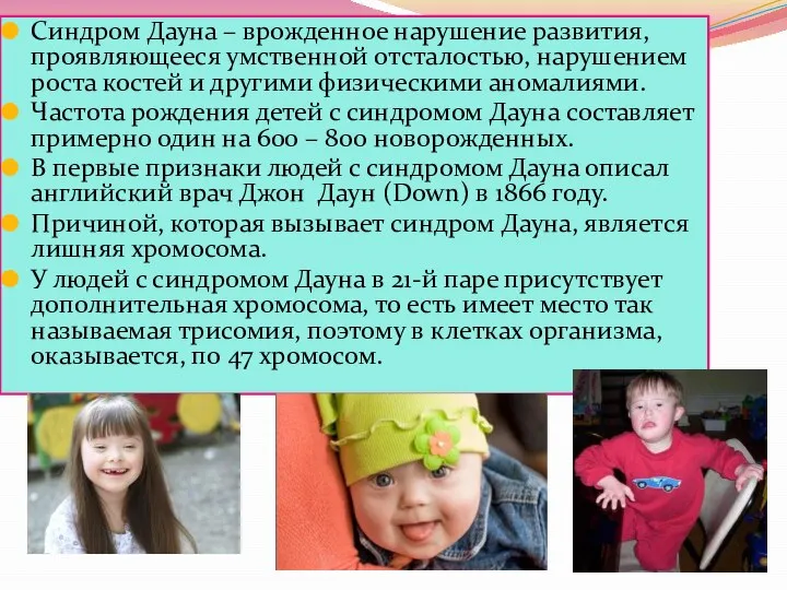 Синдром Дауна – врожденное нарушение развития, проявляющееся умственной отсталостью, нарушением роста