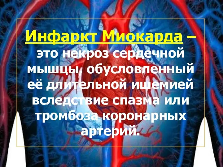 Инфаркт Миокарда – это некроз сердечной мышцы, обусловленный её длительной ишемией