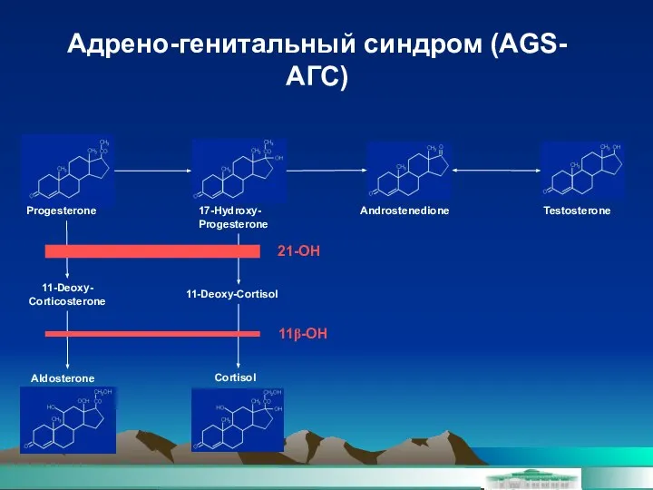 Адрено-генитальный синдром (AGS-АГС) Progesterone Aldosterone 11-Deoxy- Corticosterone Androstenedione Testosterone 21-OH 11β-OH