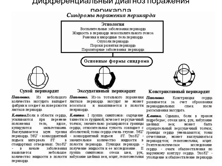 Дифференциальный диагноз поражения перикарда