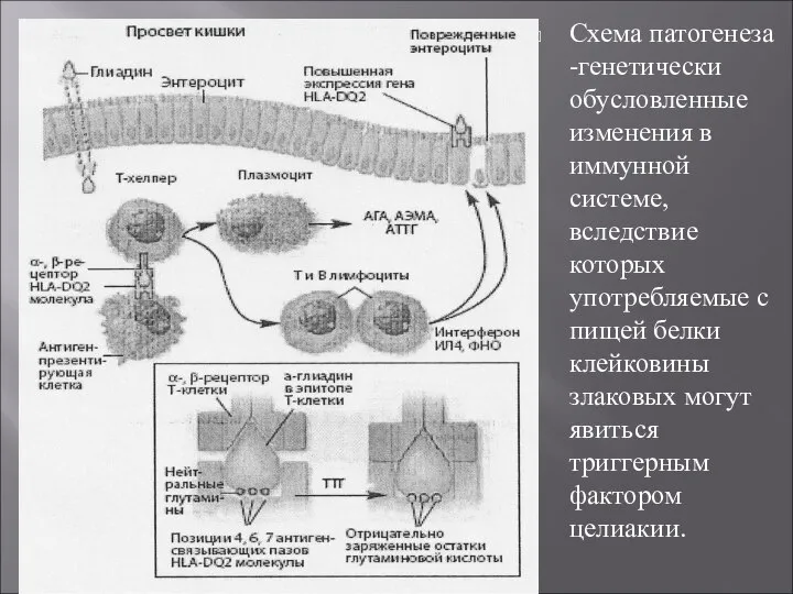 Схема патогенеза -генетически обусловленные изменения в иммунной системе, вследствие которых употребляемые