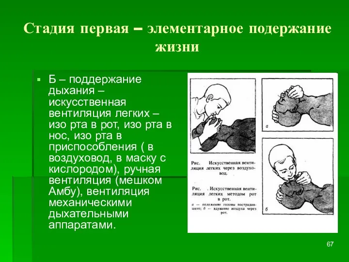 Стадия первая – элементарное подержание жизни Б – поддержание дыхания –