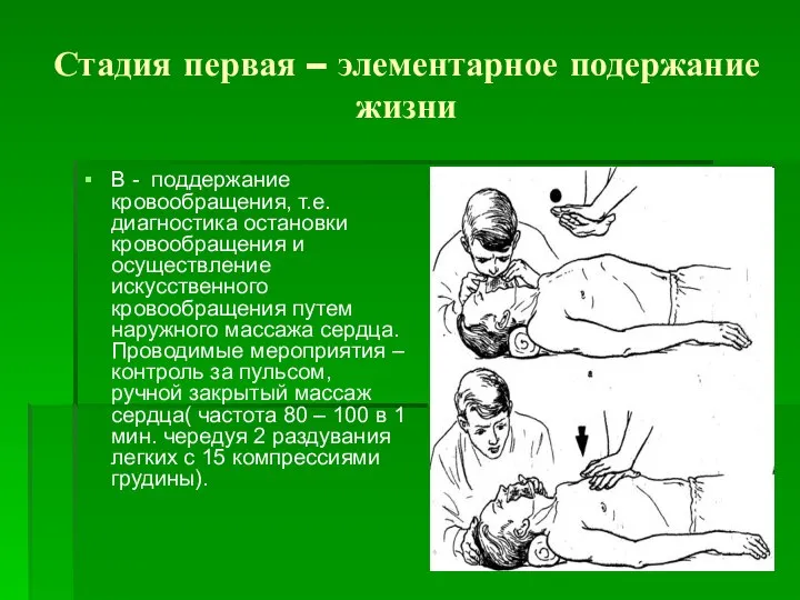 Стадия первая – элементарное подержание жизни В - поддержание кровообращения, т.е.