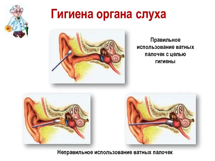 Гигиена органа слуха Правильное использование ватных палочек с целью гигиены Неправильное использование ватных палочек