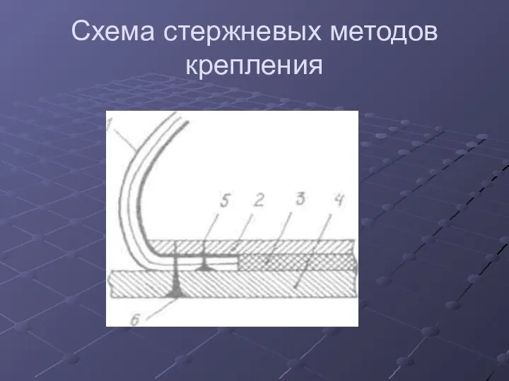 Схема стержневых методов крепления