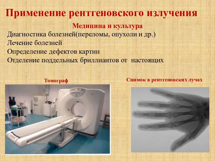 Применение рентгеновского излучения Медицина и культура Диагностика болезней(переломы, опухоли и др.)