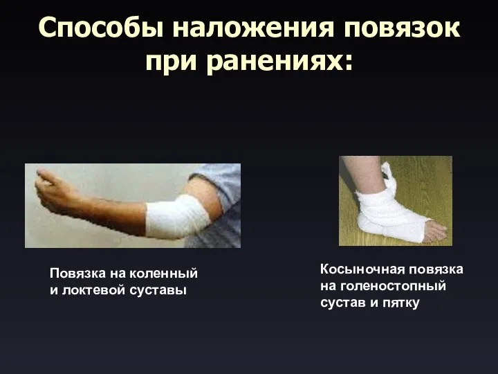 Способы наложения повязок при ранениях: Повязка на коленный и локтевой суставы