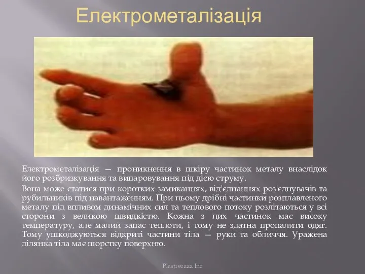 Електрометалізація Електрометалізація — проникнення в шкіру частинок металу внаслідок його розбризкування