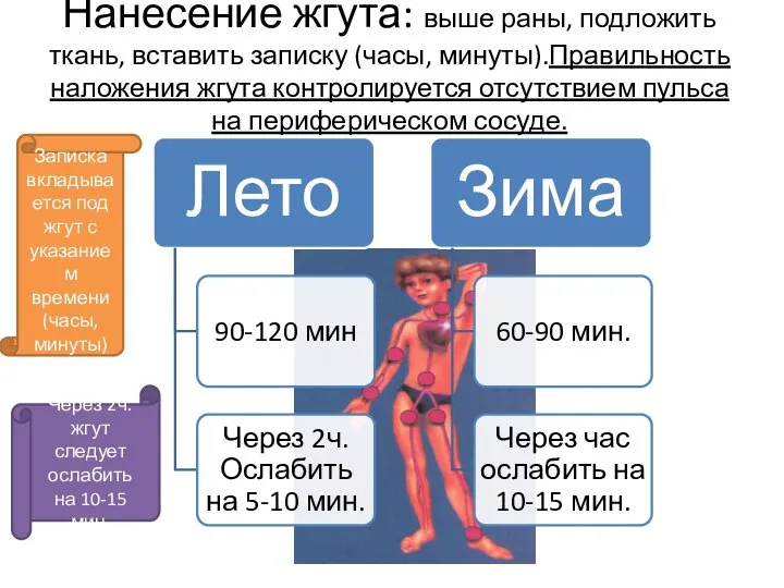 Нанесение жгута: выше раны, подложить ткань, вставить записку (часы, минуты).Правильность наложения