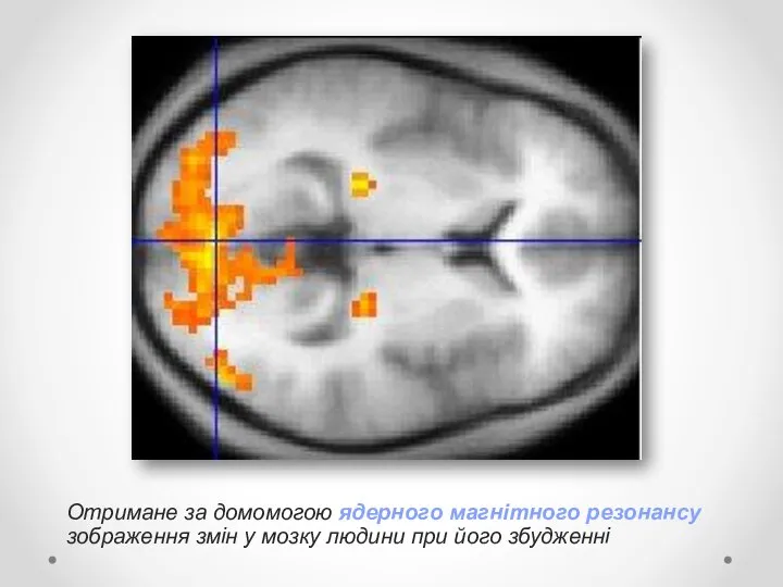 Отримане за домомогою ядерного магнітного резонансу зображення змін у мозку людини при його збудженні