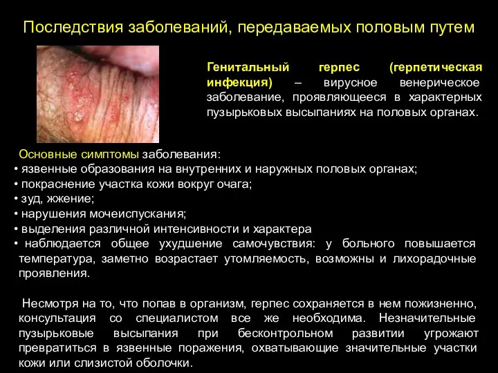 Последствия заболеваний, передаваемых половым путем Основные симптомы заболевания: язвенные образования на