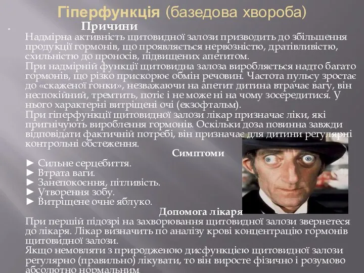 Гіперфункція (базедова хвороба) Причини Надмірна активність щитовидної залози призводить до збільшення