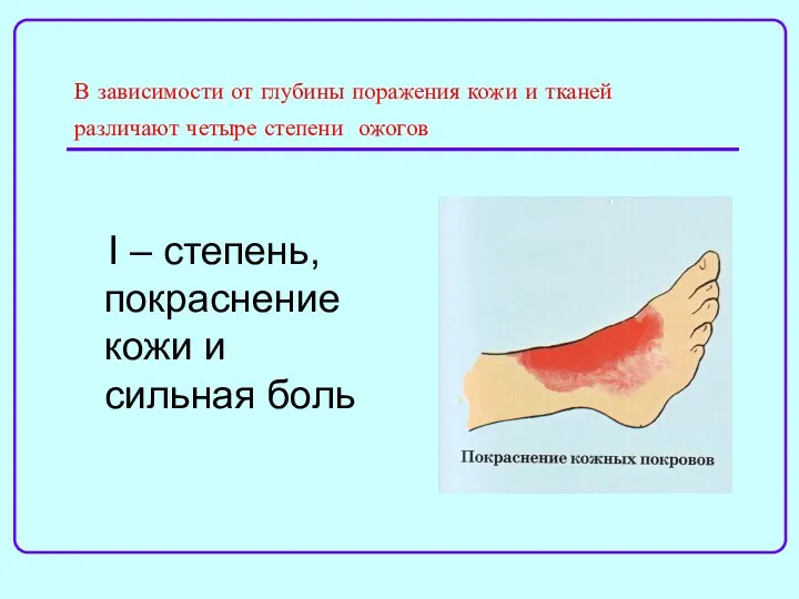 В зависимости от глубины поражения кожи и тканей различают четыре степени