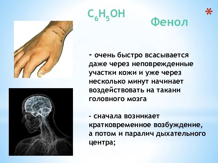 Фенол - очень быстро всасывается даже через неповрежденные участки кожи и