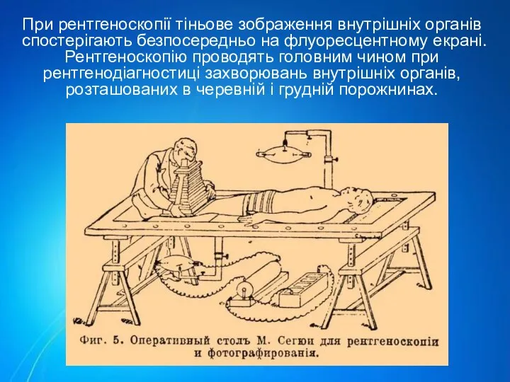При рентгеноскопії тіньове зображення внутрішніх органів спостерігають безпосередньо на флуоресцентному екрані.