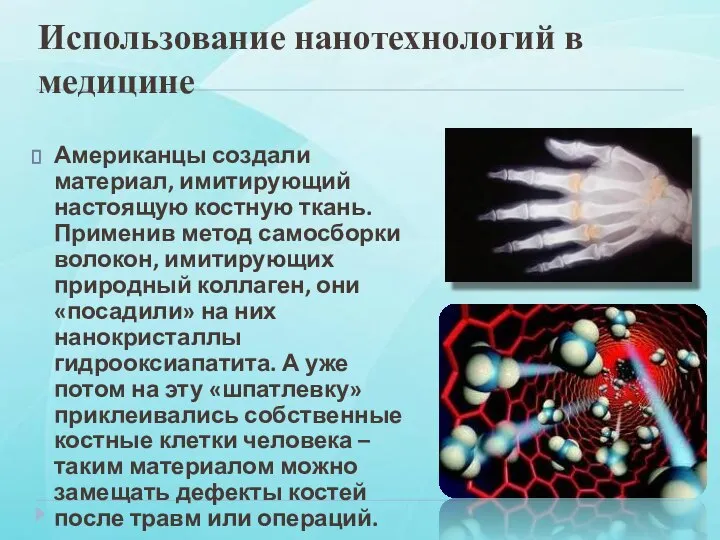 Использование нанотехнологий в медицине Американцы создали материал, имитирующий настоящую костную ткань.