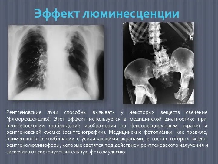 Рентгеновские лучи способны вызывать у некоторых веществ свечение (флюоресценцию). Этот эффект