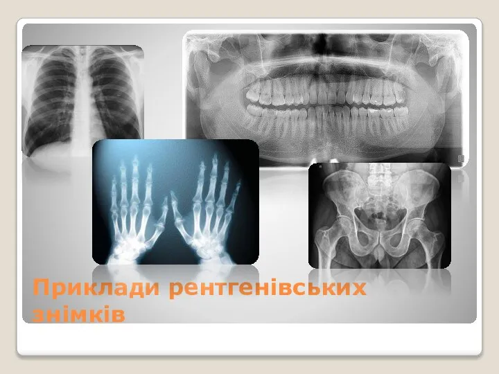 Приклади рентгенівських знімків