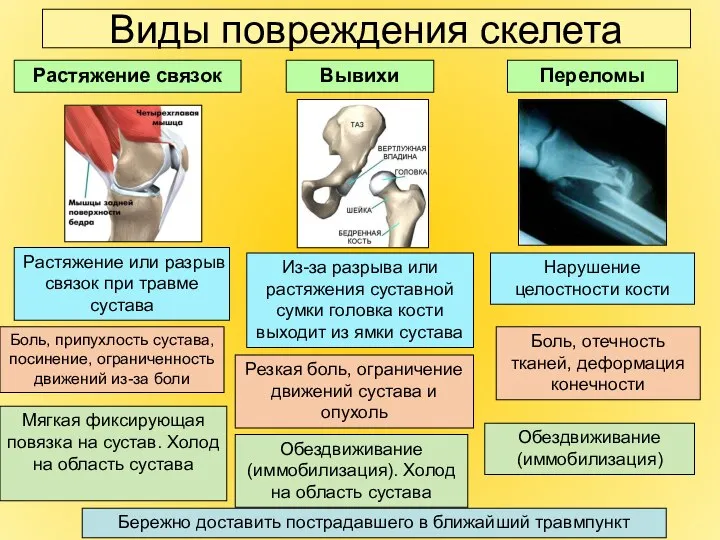 Виды повреждения скелета Растяжение связок Вывихи Переломы Боль, отечность тканей, деформация