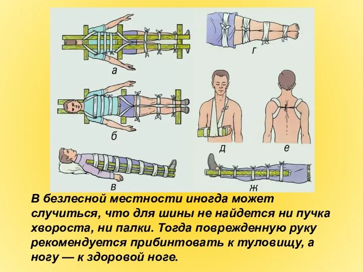 В безлесной местности иногда может случиться, что для шины не найдется