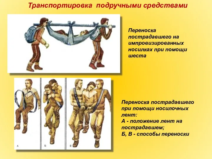 Транспортировка подручными средствами Переноска пострадавшего на импровизированных носилках при помощи шеста