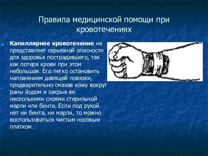 Правила медицинской помощи при кровотечениях Капиллярное кровотечение не представляет серьезной опасности