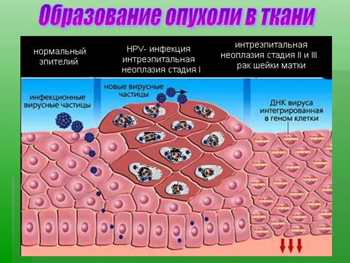 Образование опухоли в ткани