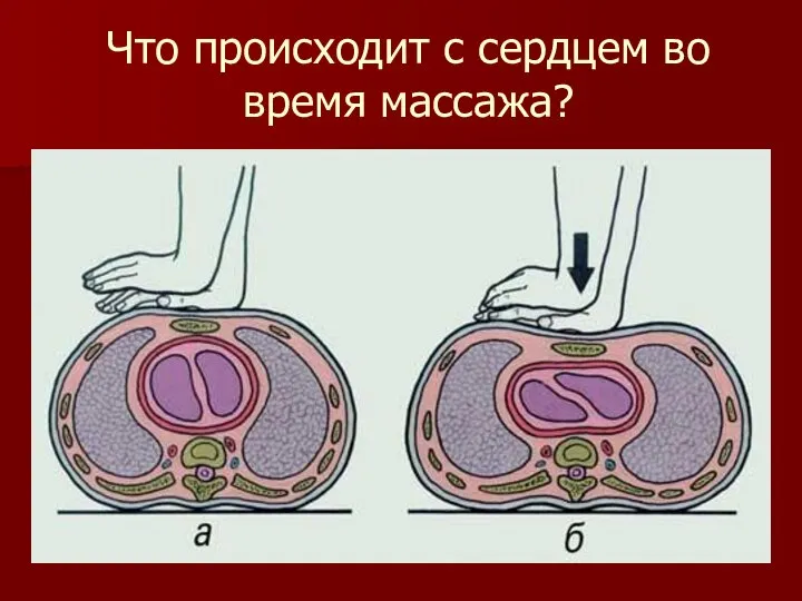 Что происходит с сердцем во время массажа?