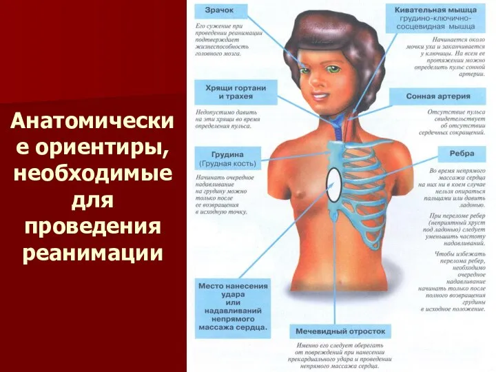 Анатомические ориентиры, необходимые для проведения реанимации