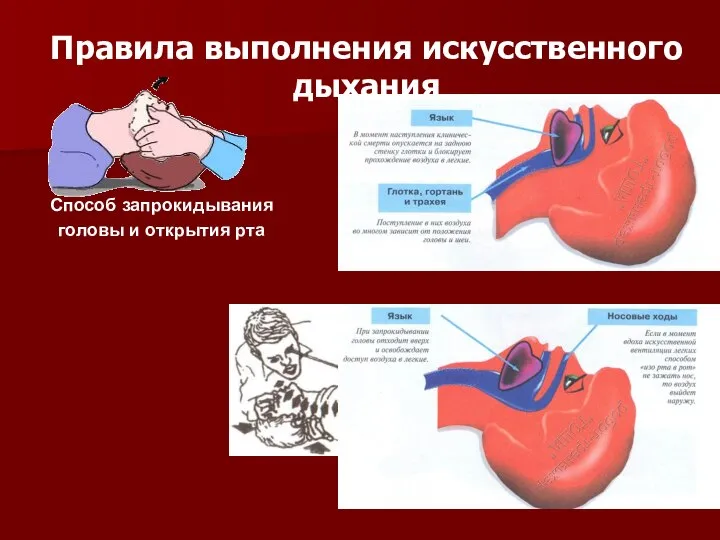 Правила выполнения искусственного дыхания Способ запрокидывания головы и открытия рта