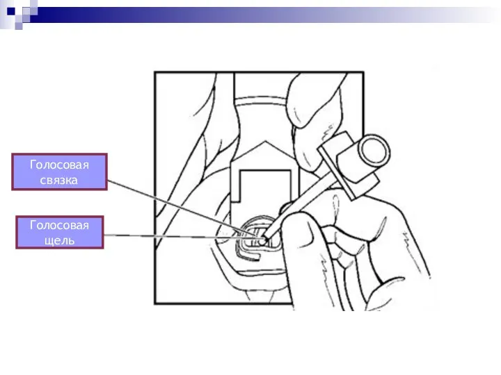 Голосовая связка Голосовая щель