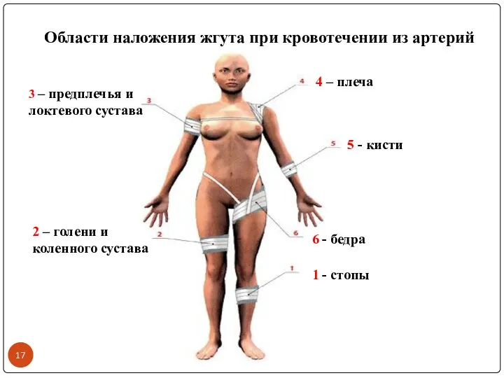 Области наложения жгута при кровотечении из артерий 1 - стопы 2