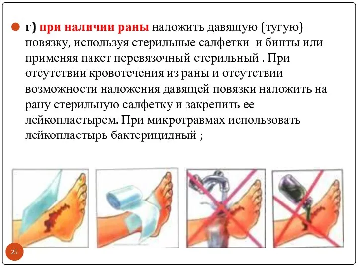 г) при наличии раны наложить давящую (тугую) повязку, используя стерильные салфетки